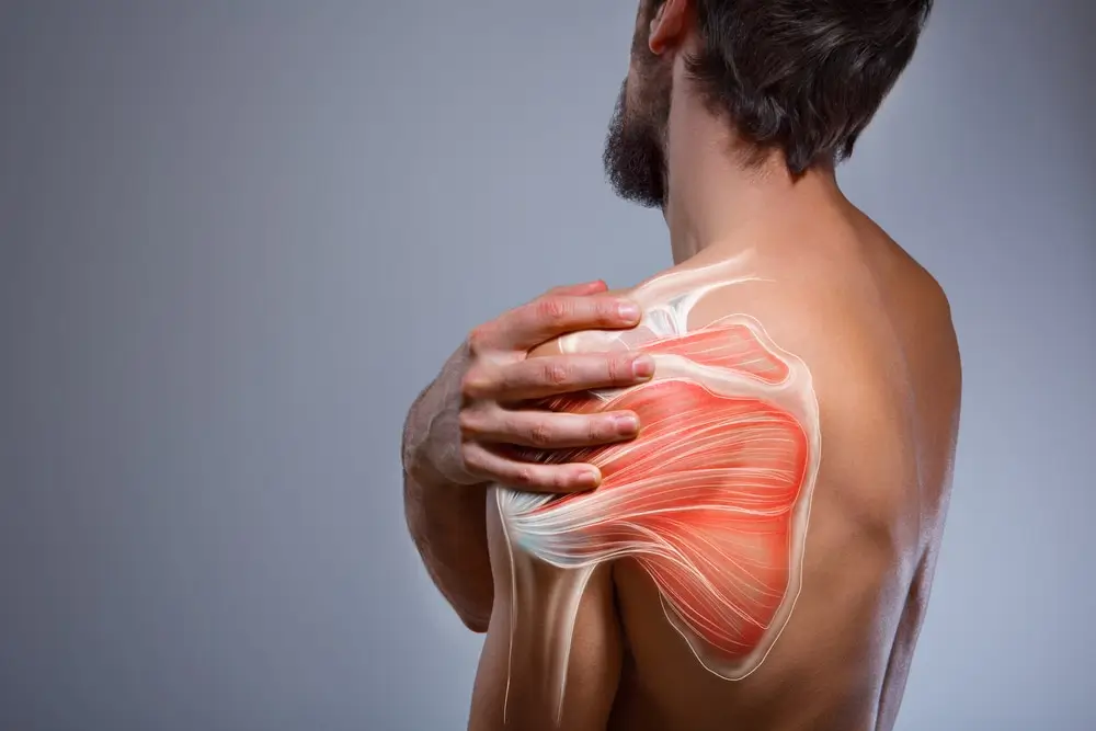 Rotator Cuff Injuries